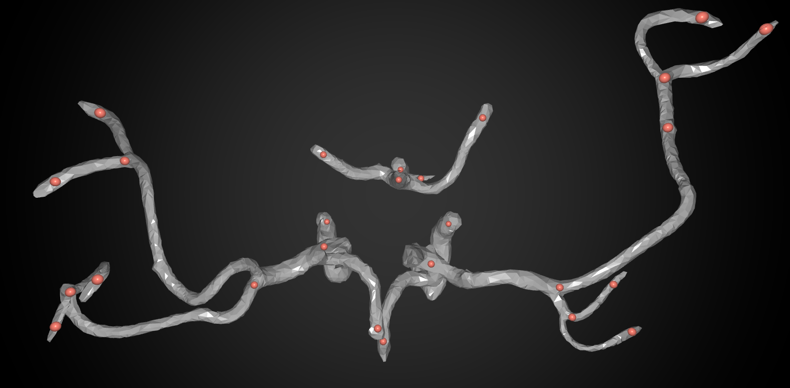 Vascular Fitting System Based On Ball B-Spline Curves